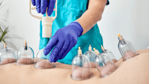 performing cupping therapy
